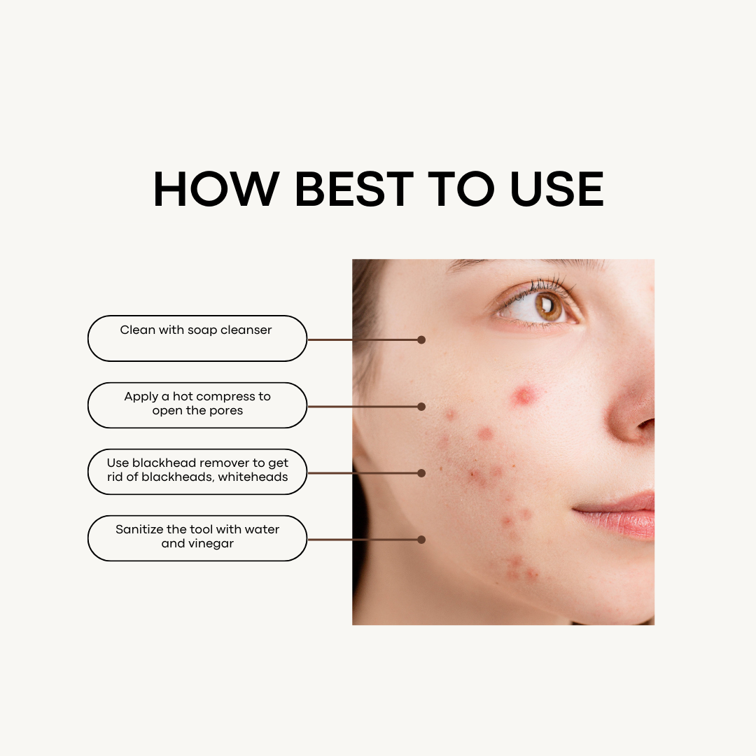 zit control- blackhead, whitehead remove