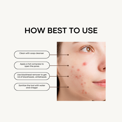 zit control- blackhead, whitehead remove